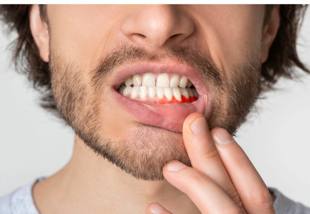 alivio sensibilidad dental