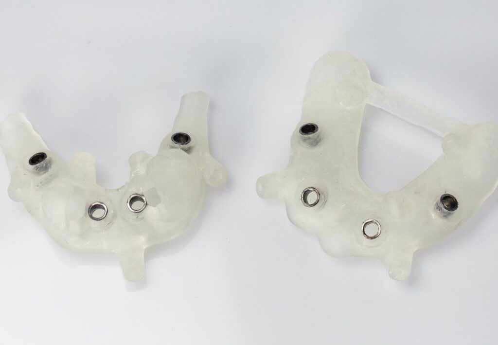 implantes dentales sin tornillos