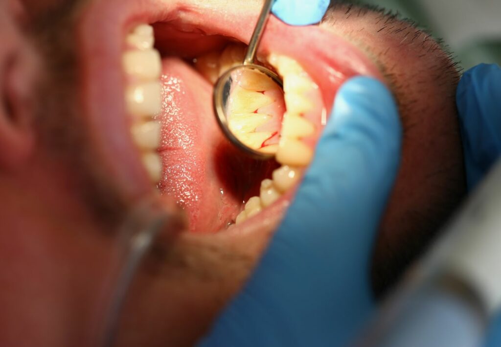 dentista Gijón