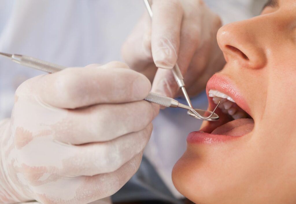 signos de periodontitis