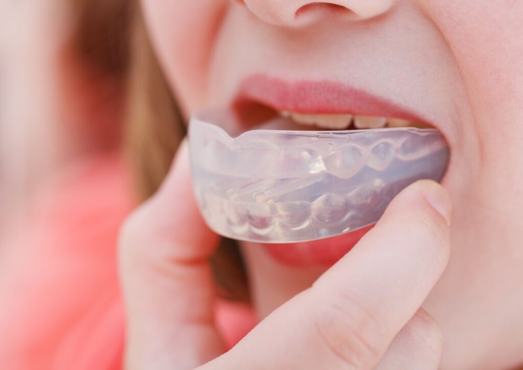 tratamiento mordida abierta