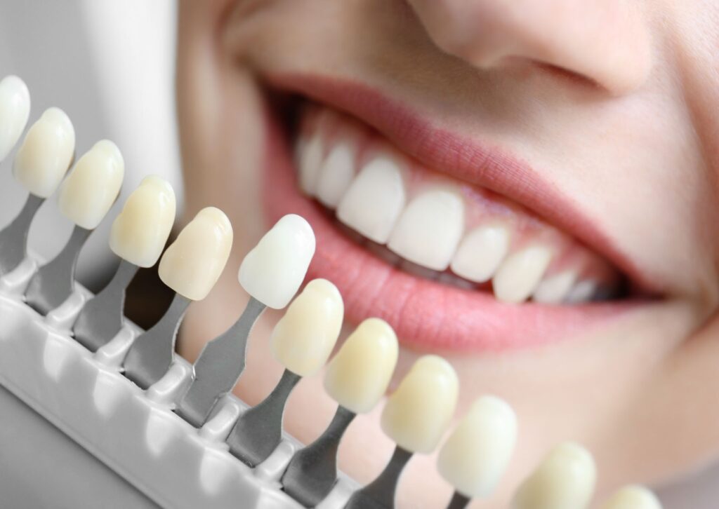 coronas zirconio