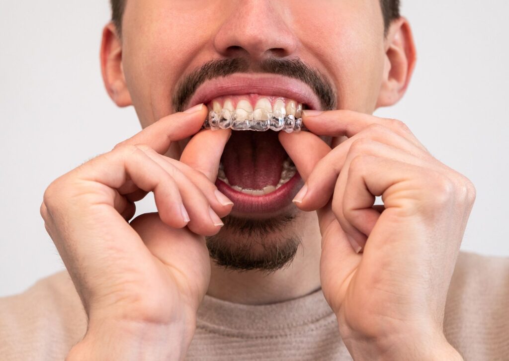 clínica dental gijón