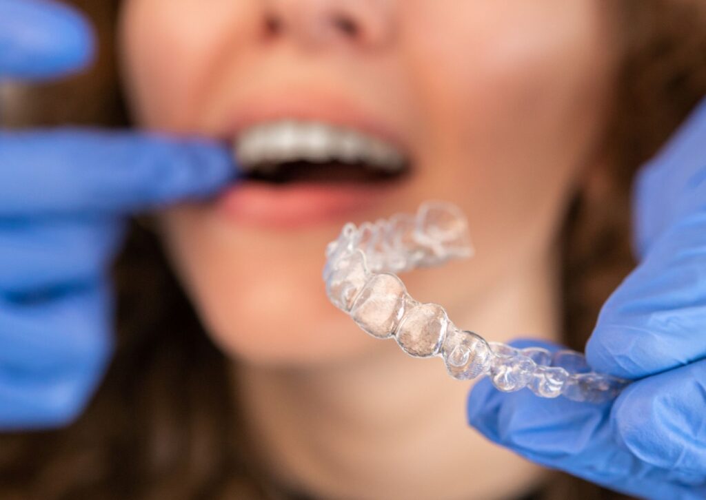 invisalign
