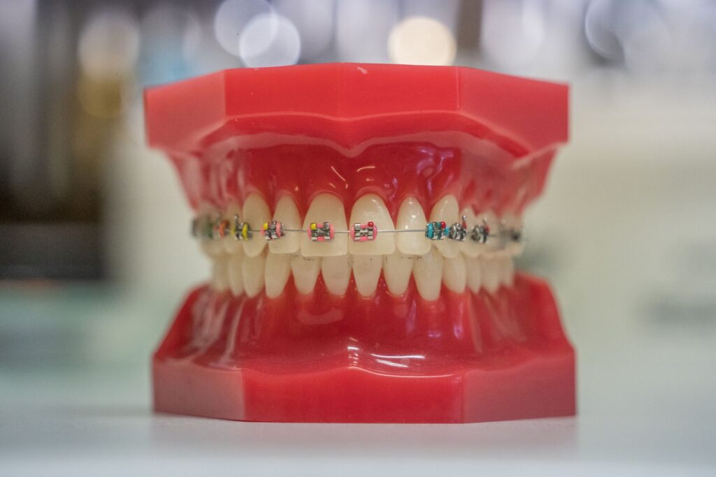 Cómo mantener una correcta higiene con brackets